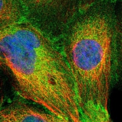 SLK Antibody, Novus Biologicals:Antibodies:Primary Antibodies